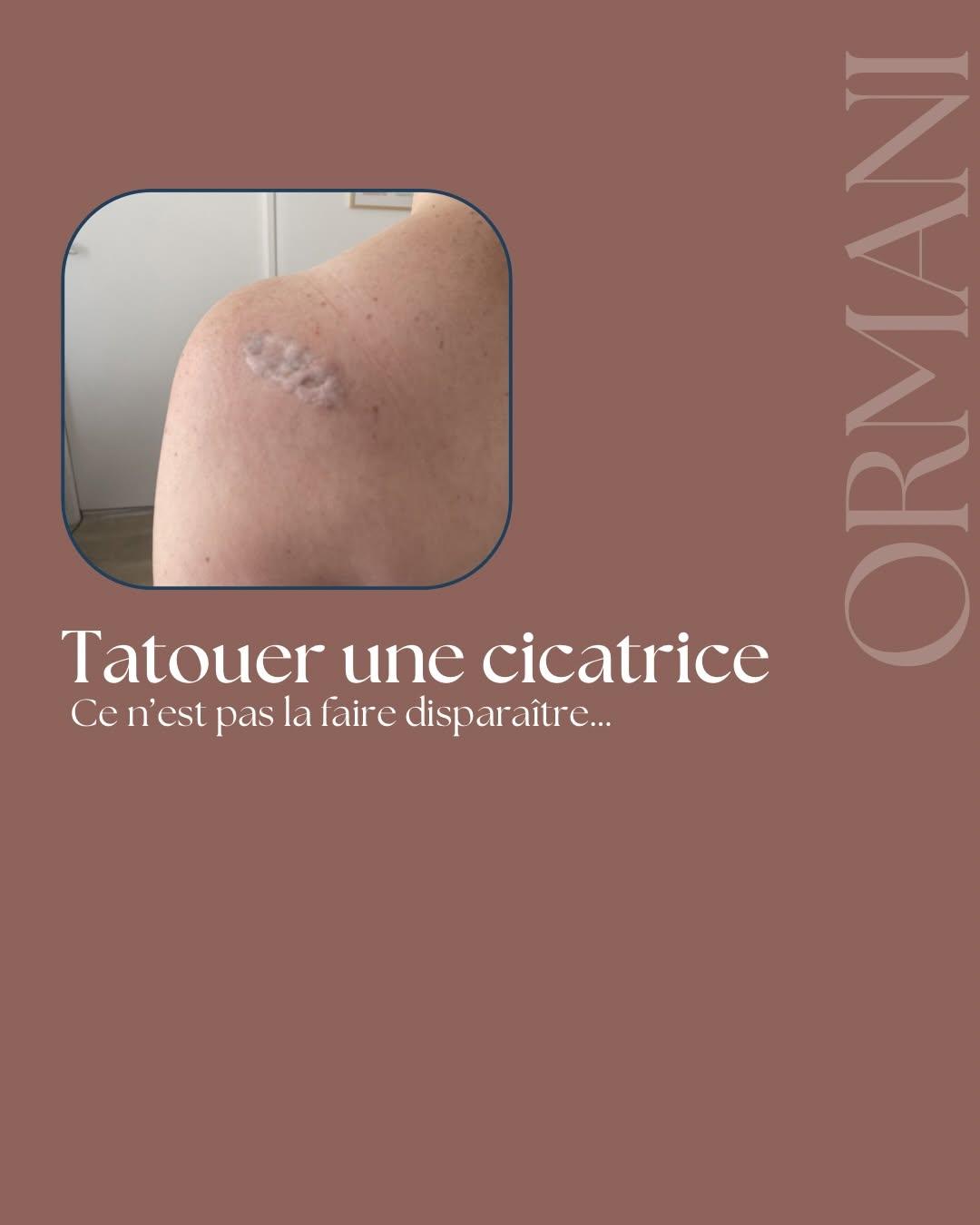 Tatouage tatouage sur cicatrice épaule — ormanitattoo