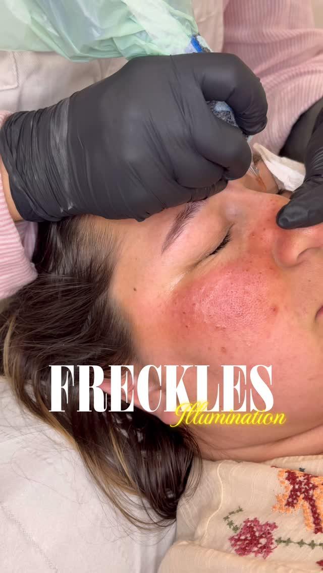 Taches de rousseur tatouées cicatrisées — cactussweetness.tattoo