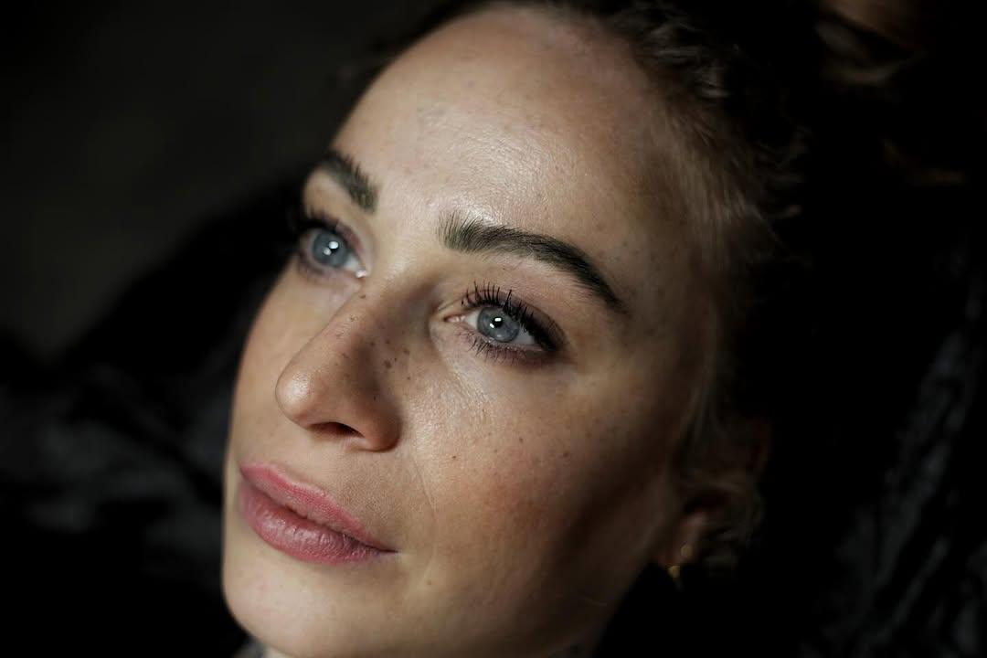 Tatouage sommes freckles cicatrisées — woke_up_like_this_munich