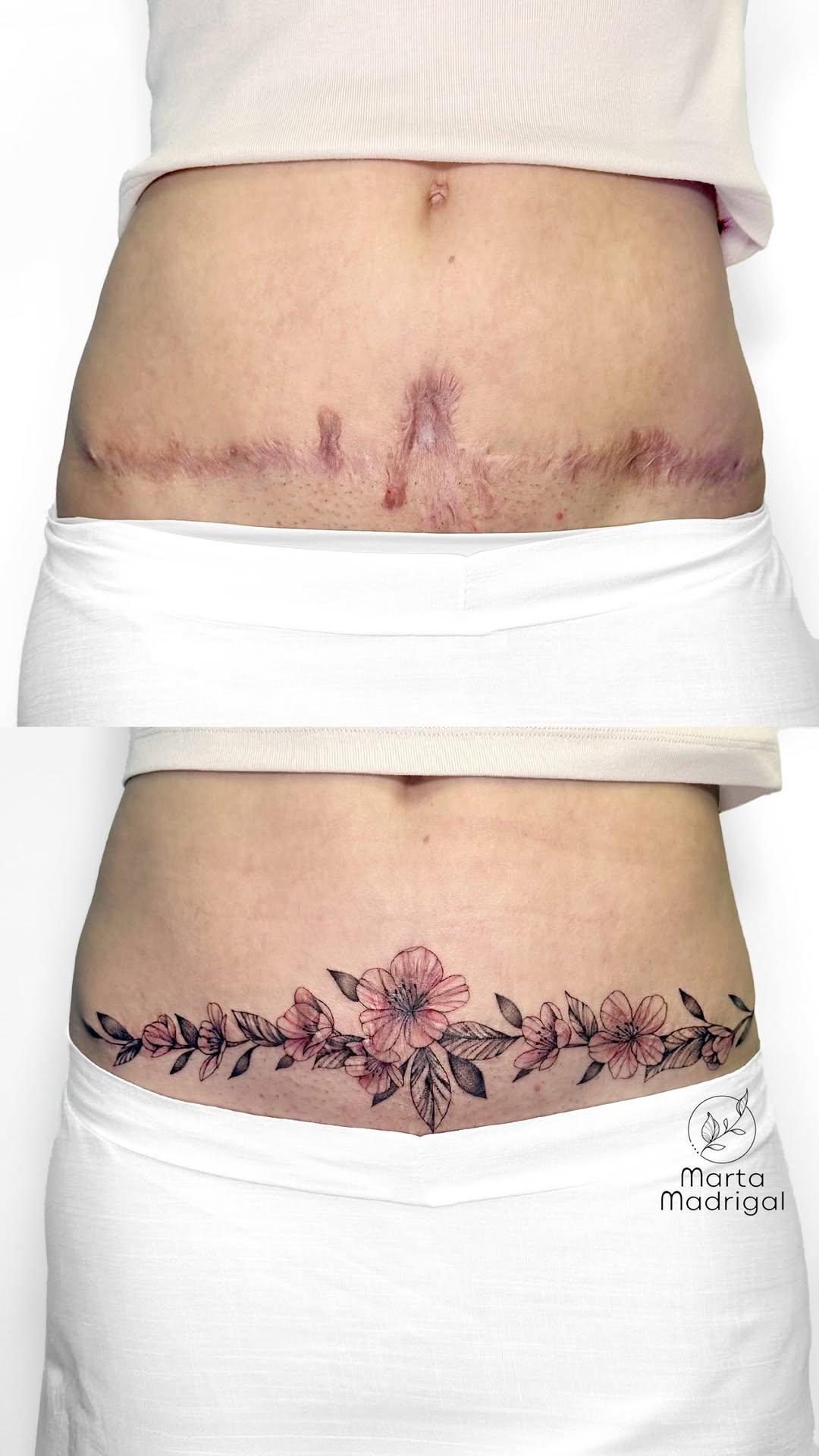 Tatouage Fleurs de cerisier recouvrant cicatrice — marta.madrigal_tattoos